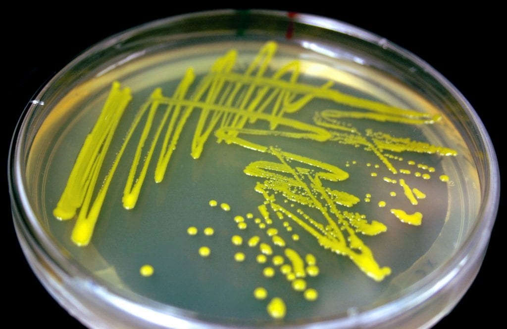 A picture of the bacterium in culture