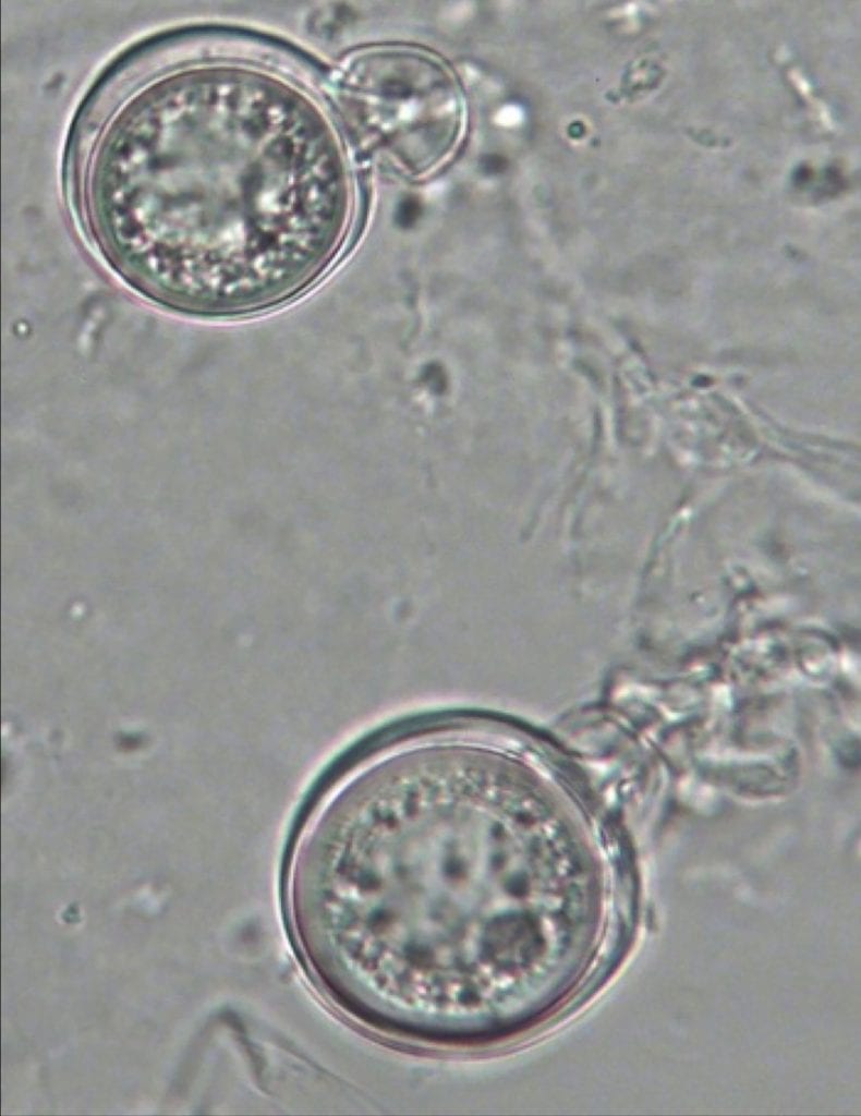 Long-lived spores, magnified 200 times