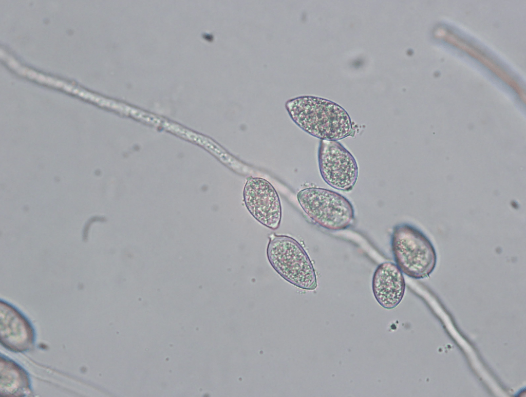 Sporangia on sporangiophores. Sporangia release zoospores that infect leaves