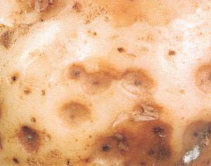 Bacterial soft rot – Erwinia carotovora subsp. carotovora (Ecc) and other bacteria